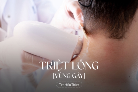Triệt lông vùng gáy